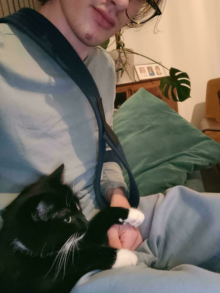 "I Broke My Elbow, But Luckily I Have A Little Doctor At Home"