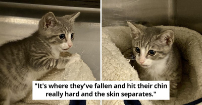 Rescued Tabby Kitten Was Given The Name "Steven Tyler" Due To A Facial Injury