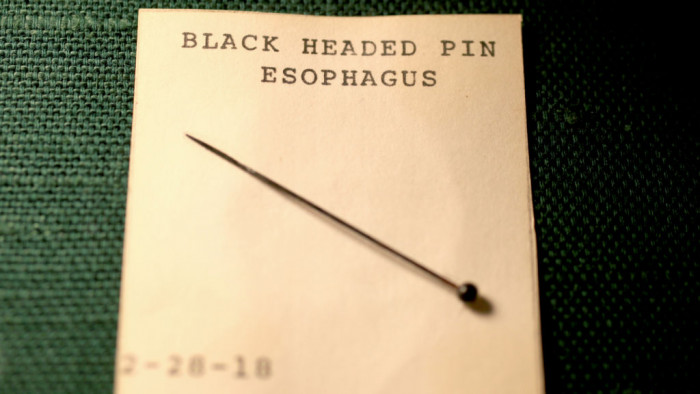 A straight pin recovered from a child’s esophagus in 1918.