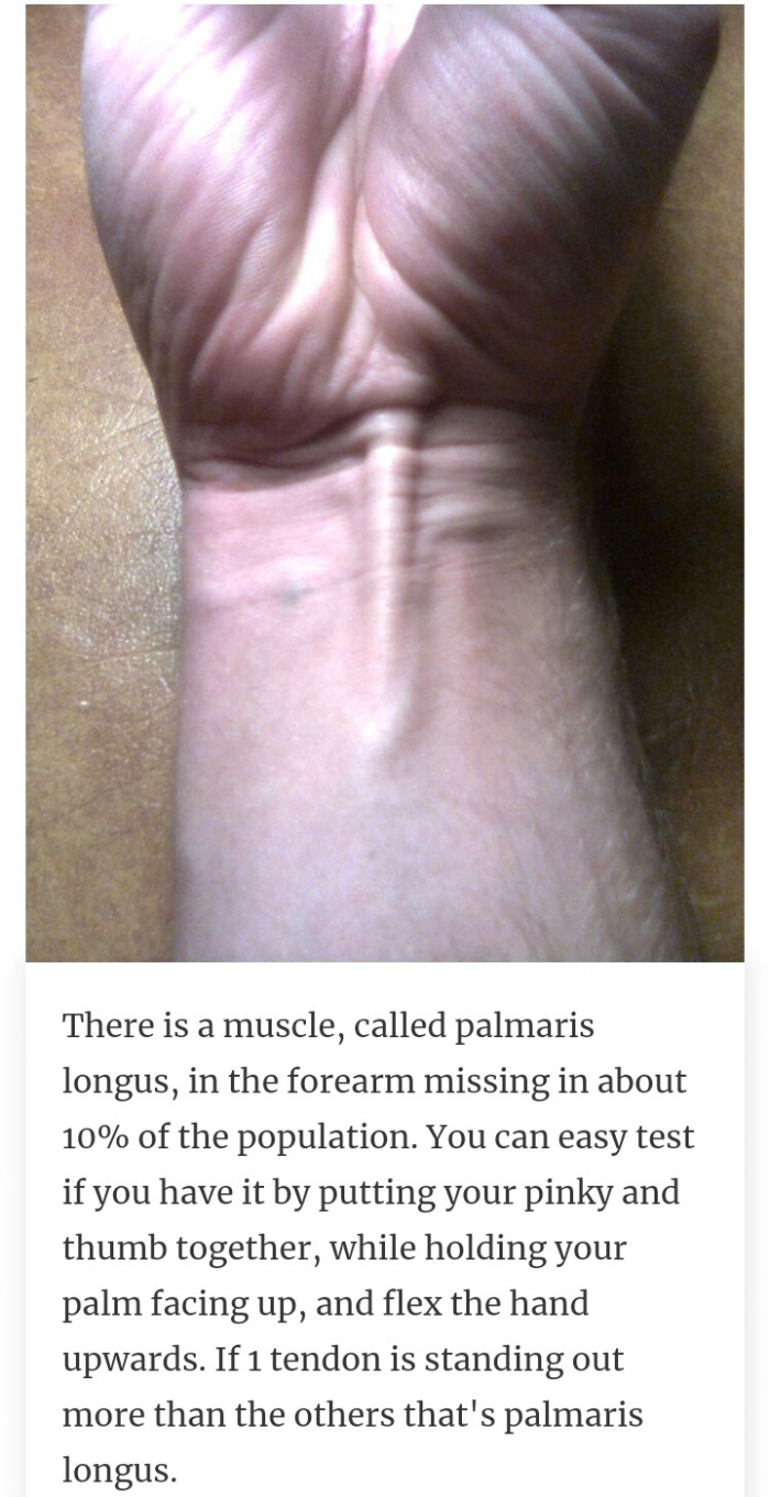 39. The palmaris longus