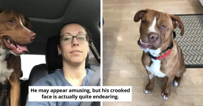 Crooked-Faced Pit-Bull With The Kindest Heart Gets Adopted By A Family That Loves Him The Way He Is