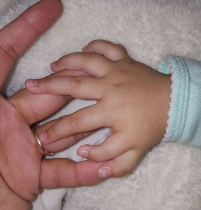 35. My Little Sister Was Born With Six Fingers