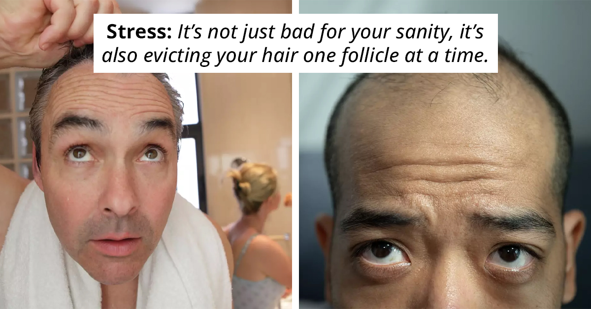 Scientists Make Groundbreaking Discovery That Might Just Be The Key To Curing Baldness For Good