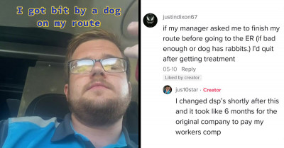 Amazon Driver Is Bitten By A Dog While On Duty And Is Shocked To Be Instructed To Finish His Route Before Going To The Emergency Room