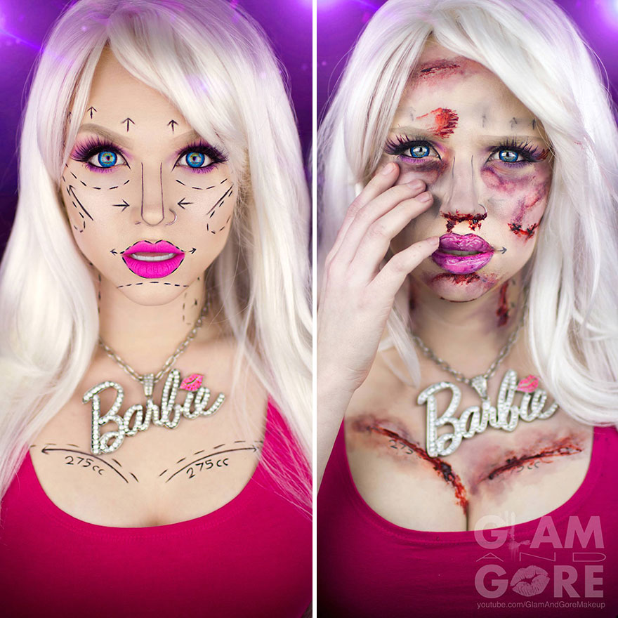 5. Barbie Before And After Failed Plastic Surgeries