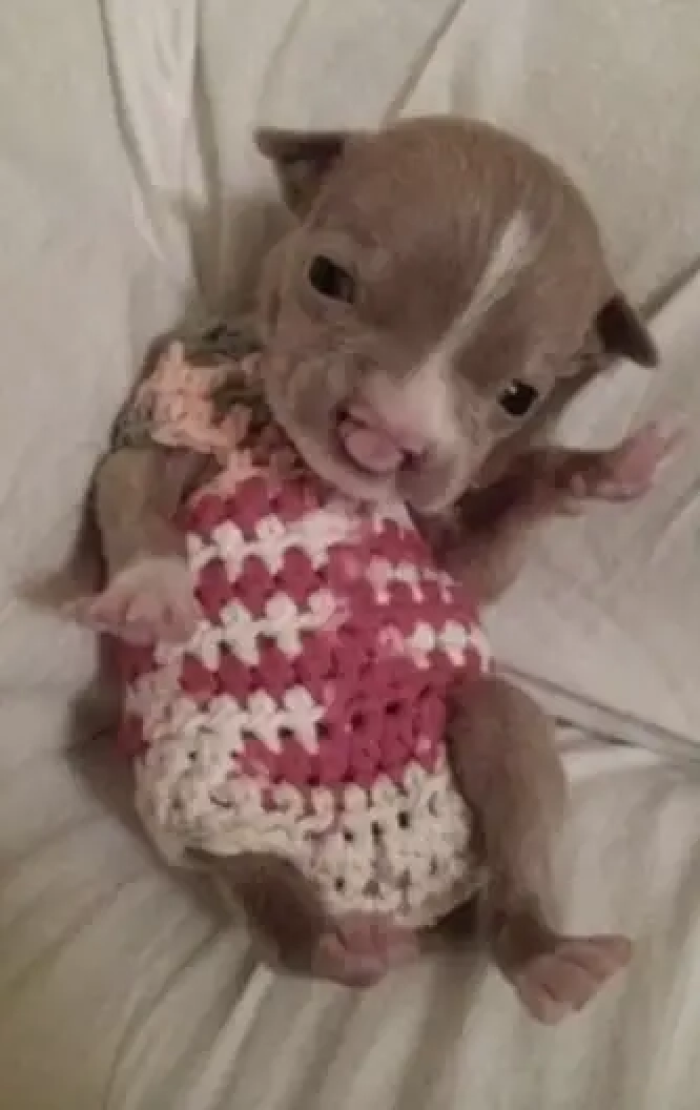 Sasha was born with several birth defects