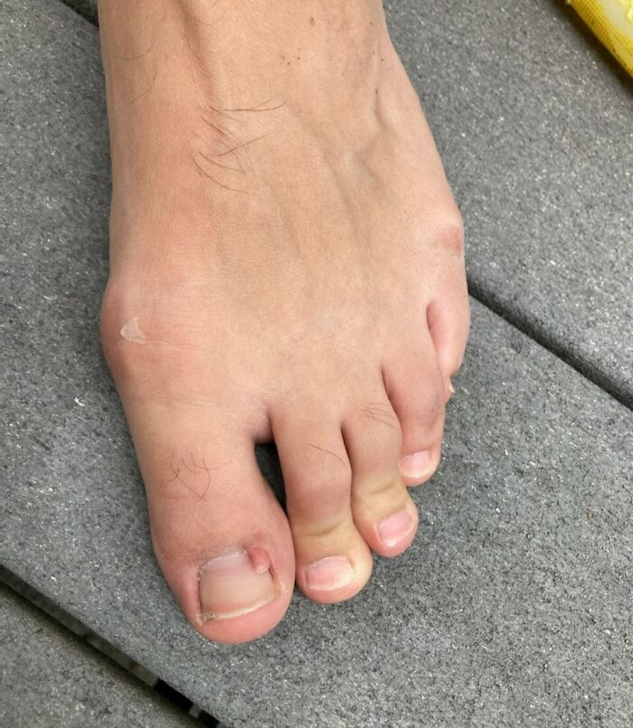 26. This Toe, With It's Own Toe, Complete With It's Own Nail